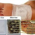 Detox Foot Patches (Set of 10) - shoponez.com®